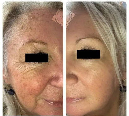 CALECIM Professional Serum CALECIM