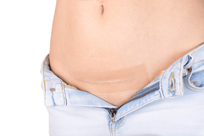 Dermaclara C-Section Patch Dermaclara